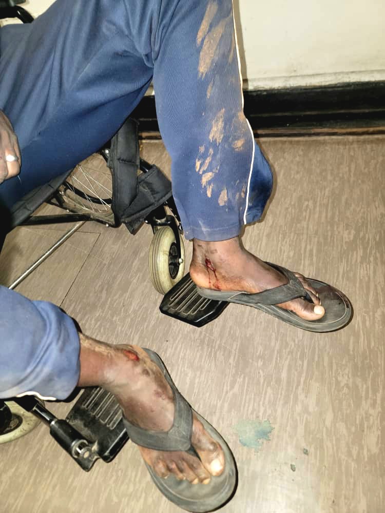 CDF Member Baird Gore Released Without Charges After Abduction And Torture Allegations