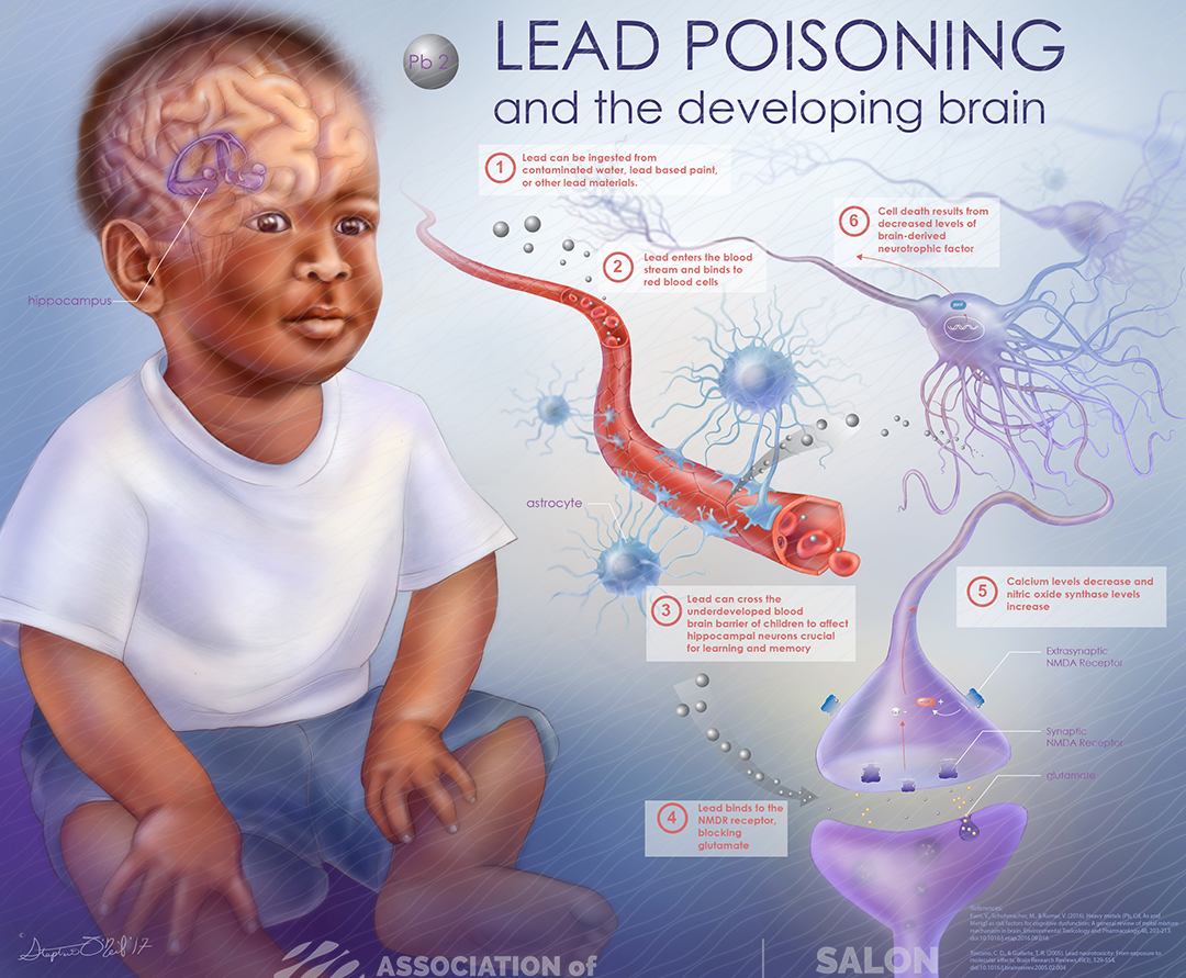 Lead Brain Damade Alert: New Poison Threatens Children